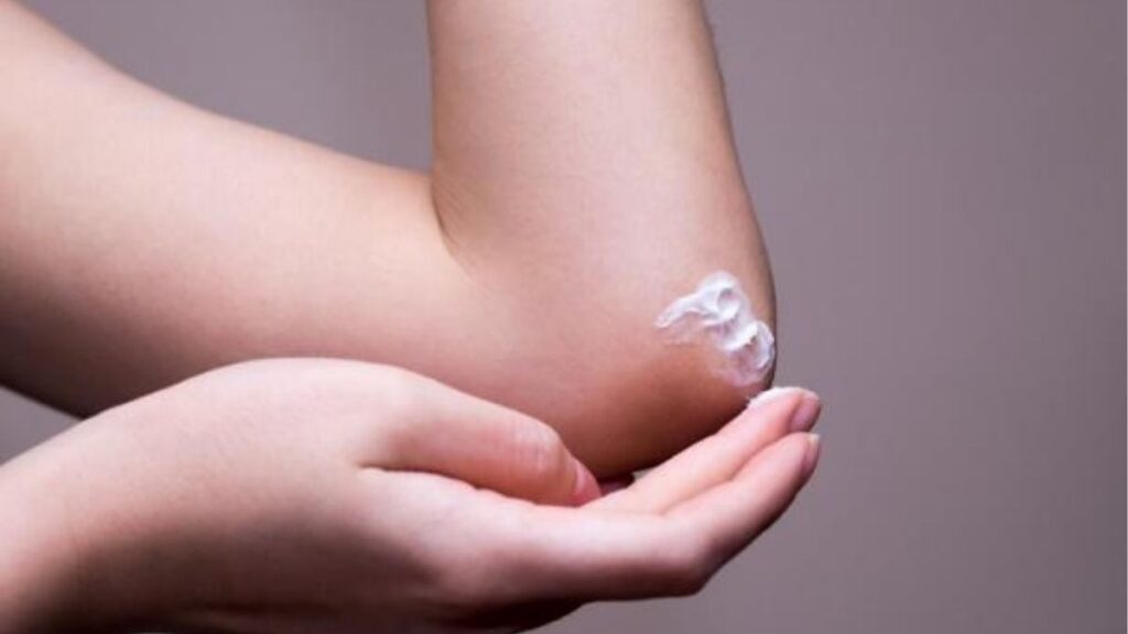 Patch Test Là Gì? Cách Thử Mỹ Phẩm Trước Khi Dùng Toàn Mặt 5 Các dấu hiệu cần theo dõi khi patch test gồm đỏ da, ngứa, sưng, phát ban và bỏng rát