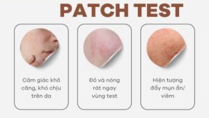 Patch test là gì và cách thử mỹ phẩm trên vùng da nhỏ trước khi dùng toàn mặt